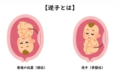 胎動の位置と胎児の向き