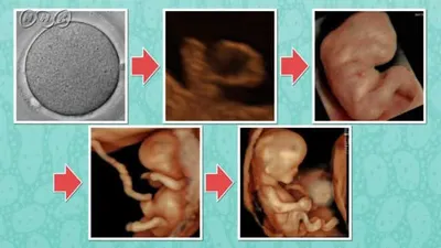 胎動からわかる赤ちゃんの体の向き
