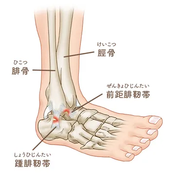 足首・足が痛い