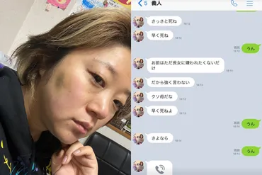 夫からの暴力&「死ね」連発LINE告白した美奈子にネットで続々集まる同情「子どもへの傷」を懸念する声も