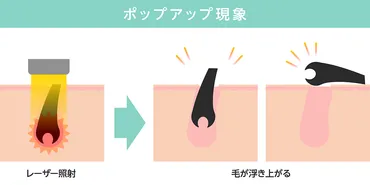 ポップアップ現象とは