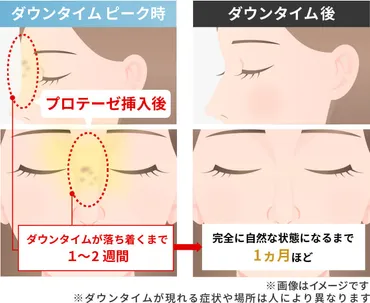 ダウンタイムとは?経過・過ごし方・短縮方法