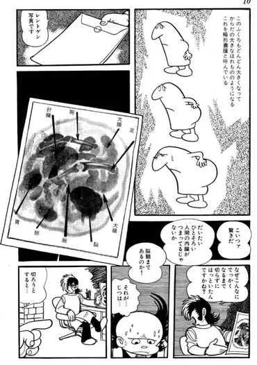 ブラックジャック・ピノコ誕生その正体は?畸形嚢腫の話は何巻で読める?