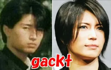 GACKTに整形疑惑が浮上!ガクトが目とエラを整形していた理由
