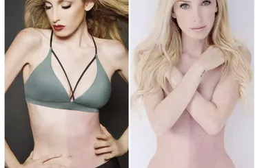 キメラ」として生まれた人間。彼女の体のあざは、双子のDNAの痕跡だった