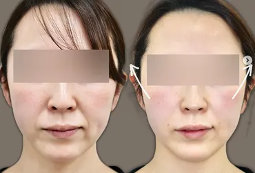 老け顔は、もう卒業！年齢に負けない美しさの秘訣とは？老け顔改善の真実とは！？