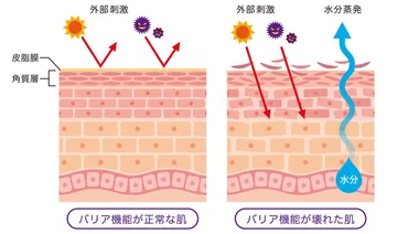 デコルテのニキビが治らない！急にできる原因と薬による治し方を解説 