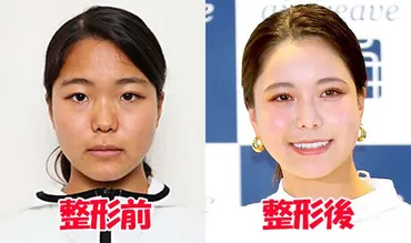 2024最新】高梨沙羅の顔変わり過ぎで怖い！鼻筋や目の変化を画像比較！