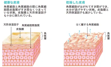 手荒れってホントに治らないの？手荒れの原因と対策を徹底解説!!