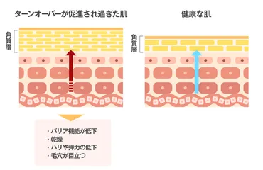 肌のターンオーバーを促進させる方法～促進され過ぎるデメリットも解説～ 