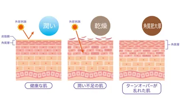 秋冬の美肌づくりの鍵は、「角質」が握っている？