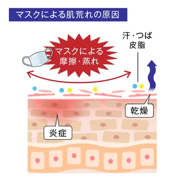 マスクで肌荒れが起こりやすい原因と対策