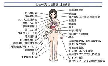 膠原病って一体ナニ？治療法は？(疑問形)膠原病の治療の現状と課題とは!!?