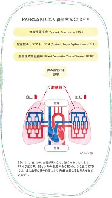 膠原病とPAH（CTD