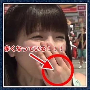 もえあずが歯を整形?歯がない理由は吐きダコや糖尿病だったの?