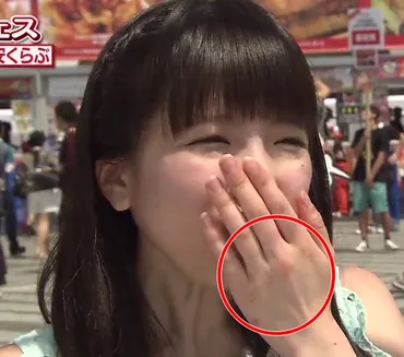 もえのあずきの吐きダコがヤバイ!八重歯がないのは過食嘔吐が原因?