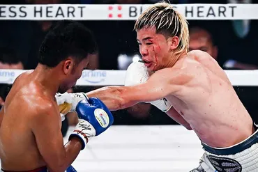 那須川天心、ボクシング初のタイトル獲得!ダウン奪取で判定勝ち、流血激闘に「大事な顔に傷つけやがって…顔で売ってるのに」