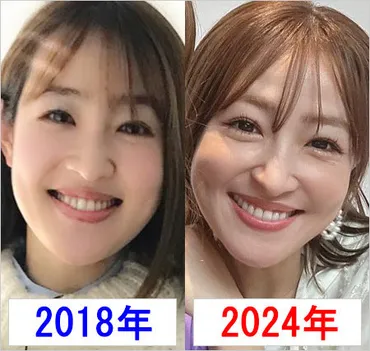 大沢あかねの顔の変化は整形？美容法や夫・劇団ひとりとの関係について解説！（真実？疑惑？）大沢あかねの美の追求！整形疑惑から美容法、夫・劇団ひとりとの関係まで徹底分析