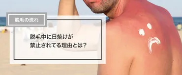 脱毛箇所は日焼け禁止？日焼け止めや保湿クリームを塗って、丁寧にケア