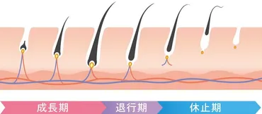 髭脱毛で間隔を空けすぎてしまうとどうなる！？事例を含めて解説