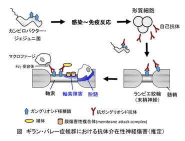 ギラン・バレー症候群（GBS）とは？原因、症状、治療法を徹底解説！GBSの基礎知識から最新情報まで、わかりやすく解説
