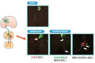 共同発表：多発性硬化症で傷ついた神経が自然に再生するメカニズムを発見