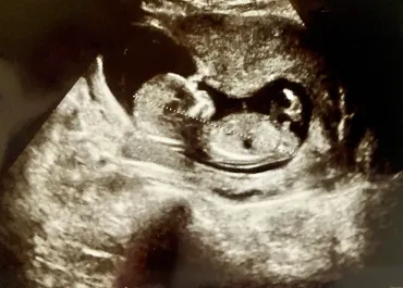 4Dエコーとは？メリットやおすすめ時期、値段の相場を解説！