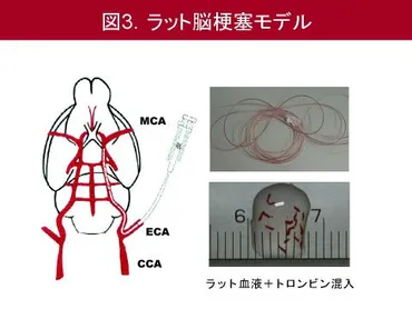 血栓溶解療法後の脳出血防止を目指した新しい治療法の開発 