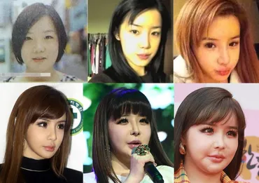 整形失敗が噂されている韓国アイドル10人！ビフォーアフター写真もチェック！ 