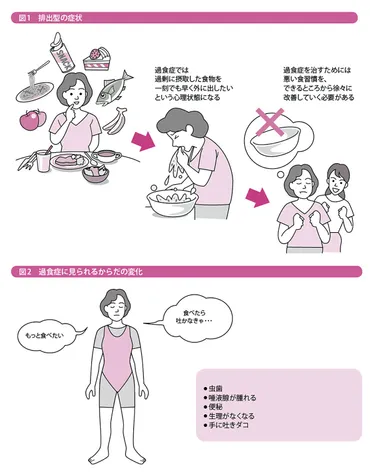 拒食症と表裏一体の過食症。交互に繰り返すことも少なくない