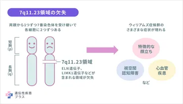 ウィリアムズ症候群とは？〜原因、症状、治療法を徹底解説！〜ウィリアムズ症候群の基礎知識と、その症状、治療、そして社会との繋がり