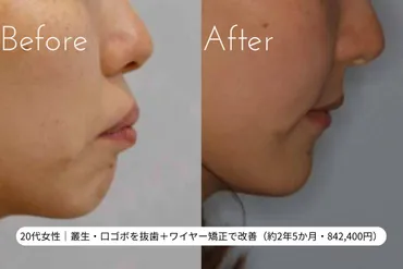 Eラインとは？理想的な横顔の診断基準とは？矯正医が解説 