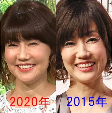 松本伊代の顔が変わり整形疑惑も真相は…頬がパンパンに突っ張り別人レベル? 注射し過ぎ?の声も。画像あり
