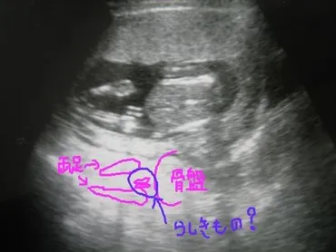 性別判明？！でもやっぱりわからん。（妊娠15週0日）