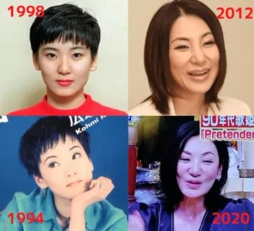 広瀬香美の顔が変わって怖い、苦手の声…整形で目や鼻をいじった説は本当？ 