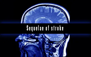 脳梗塞の後遺症なしで済む場合とは？
