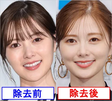 白石麻衣がホクロ除去施術で顔が激変か。整形否定の過去もコンプレックスで決断? ネットで賛否の声。画像あり 