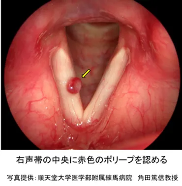 耳鼻咽喉・頭頸科