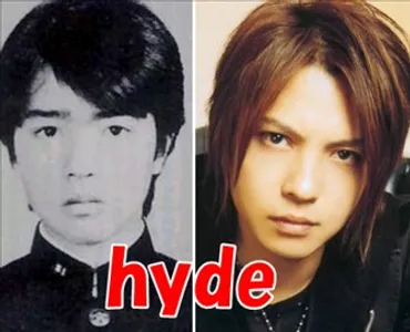 hydeが目とアゴを整形していたことが判明?昔と顔が違うという噂