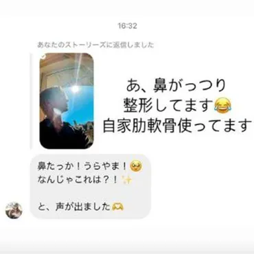 Matt、鼻の整形告白に「整形してないと聞いた方が驚くレベル」の声(DailyNewsOnline)