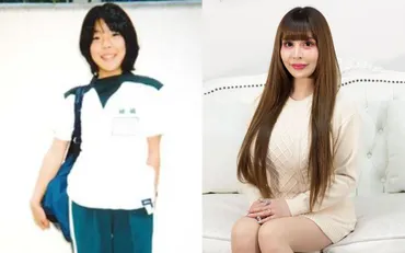 髪の毛がついたまま頭皮をベロンとめくって…」総額3億円! 全身整形美女ヴァニラが体験した゛壮絶手術゛とは?