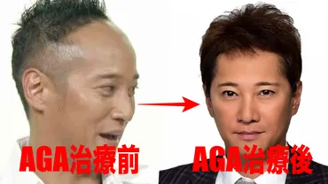 中居正広の生え際の薄毛対策はAGA治療!植毛・かつら疑惑も暴露!