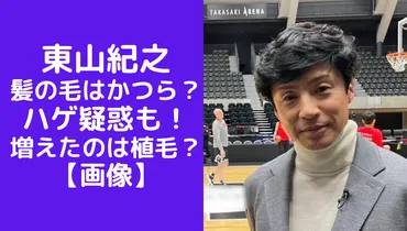 画像】東山紀之の髪の毛が不自然で変なのはかつら?ハゲ疑惑も!増えたのは植毛?