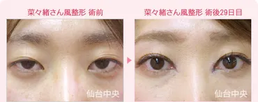 菜々緒の整形/綺麗でカッコいい/仙台中央クリニック