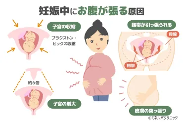 妊娠によるお腹の張りとは?症状や対応方法について詳しく解説