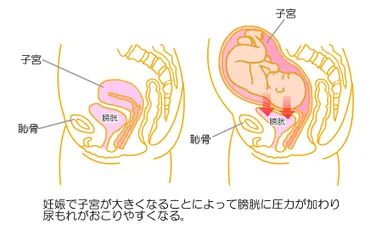 妊婦に起きやすい尿もれ対策【妊娠中のトラブルシューティング・8】