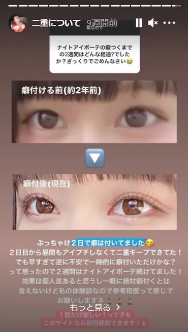 海老原まよい(大食い)の整形は鼻だけ目はしてない?彼氏の存在や所属事務所も調べてみました!