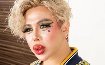 ある日いきなり少年院へ、顔がかわいいから狙われまくって…」1億円超の整形男子・アレンが明かす「不良時代」そこから更生できたワケ