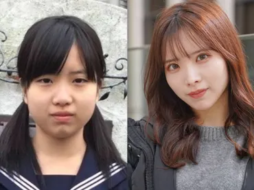 500万円かけて整形した元STU48、現役アイドルが「初めての整形は中学2年生のときに…」(女子SPA!)