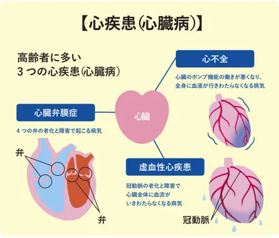 心臓の病気の種類
